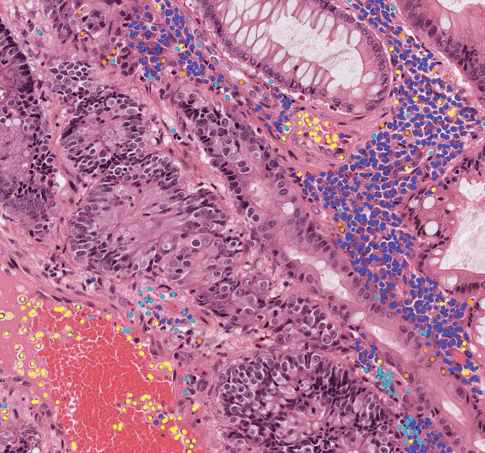 Immune cells mapped on H&E · Octo Immune