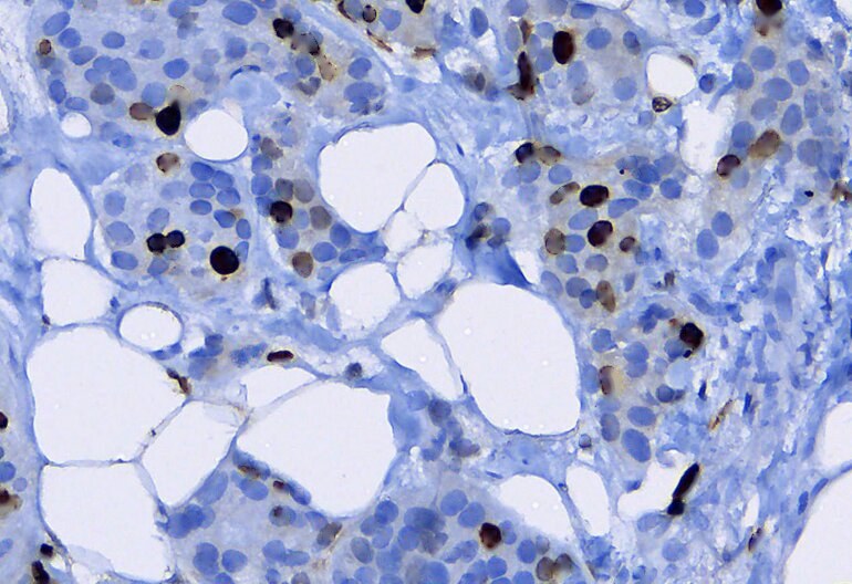 Ki67: raw IHC